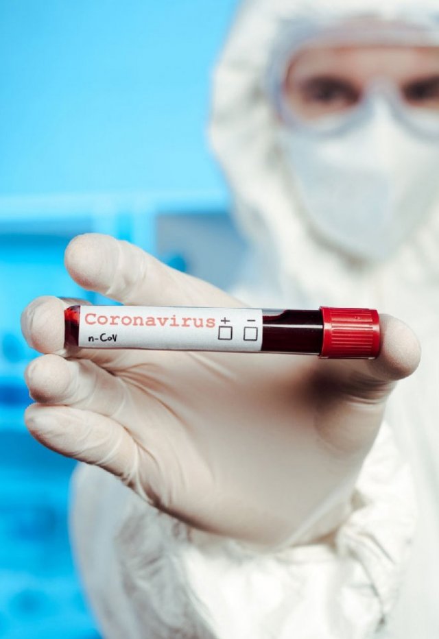 Российские ученые выяснили, как коронавирус влияет на аллергиков
